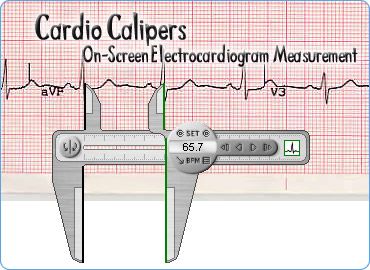 Pantallazo Cardio Calipers